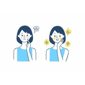 マスク肌荒れ・ニキビを防ぐ方法｜摩擦や蒸れを抑える正しいマスクニキビケアとマスクの選び方